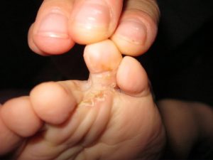 Скритите рискове на басейните