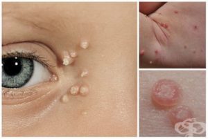 Скритите рискове на басейните